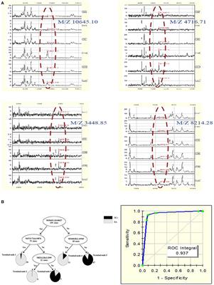 Establishing Classification Tree Models in Rheumatoid Arthritis Using Combination of Matrix-Assisted Laser Desorption/Ionization Time-of-Flight Mass Spectrometry and Magnetic Beads